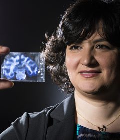 New study shows that electrical stimulation can reduce brain damage after stroke Thumbnail